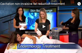 Cavi Lipo